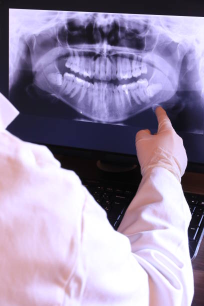 Best Emergency Tooth Extraction in Westernport, MD